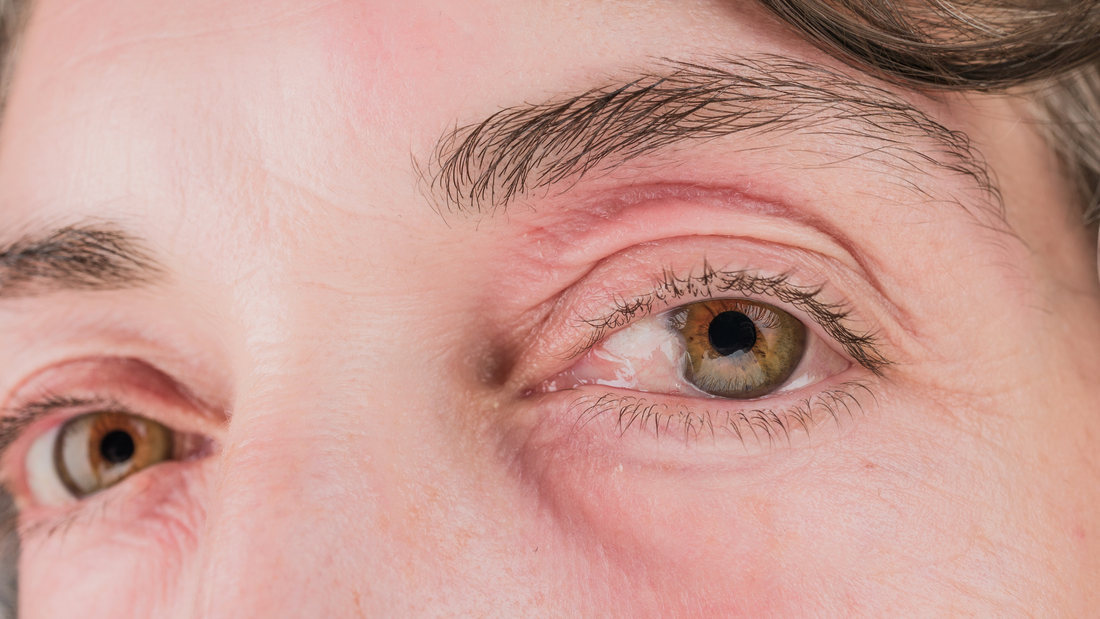 Common Eye Conditions You May Inherit from Your Family